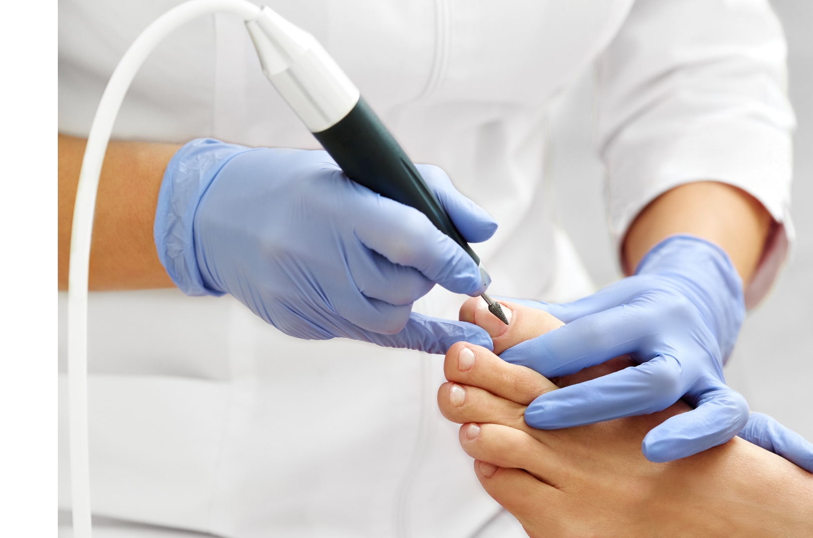 קרוס פדיקור רפואי מקצועי במרכז